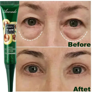 Creme para os olhos removedor instantâneo de rugas, linhas finas, antienvelhecimento, olheiras, bolsas, inchaço, cuidados com a pele da área dos olhos.